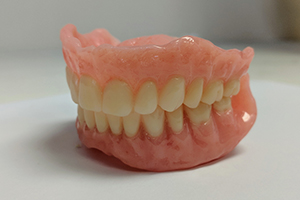Dentures in Ontario, CA, Denture Options